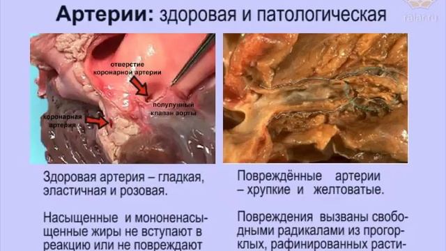 Часть № 5. Питание. Мудрые традиции предков – ключ к отличному здоровью! смотреть онлайн