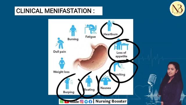 PEPTIC ULCER | GIT Disorder | MSN | #nursingexam #B.scnursing #gnm #nurses смотреть онлайн