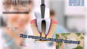 Как очистить язык от налета?