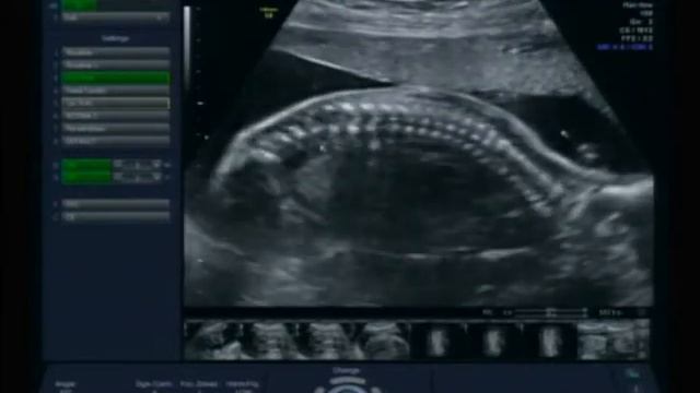 ecografia da luiza; andre e dani смотреть онлайн