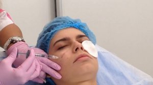 АирисКом: показ преподавателя заполнение носослезной борозды