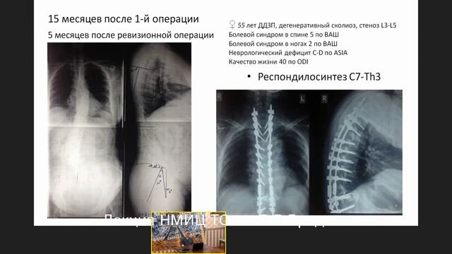 Современные интервенционные методы лечения болевого синдрома у пациентов пожилого возраста.