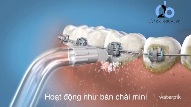 Công dụng các đầu tăm nước H2ofloss смотреть онлайн