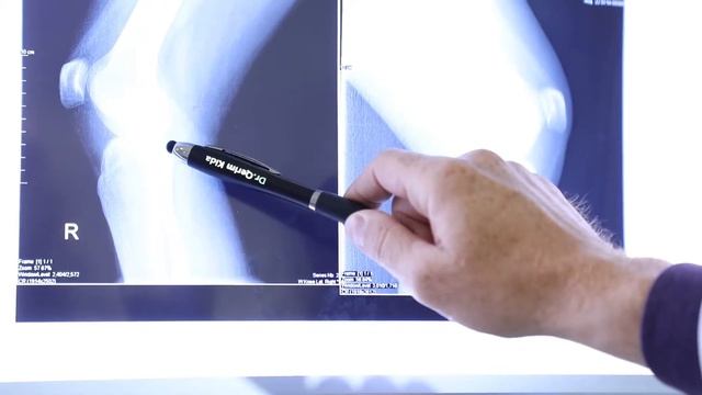 Intervistë me Dr. Agron Mahmuti - Fazat e trajtimit të pacientëve në Royal Medical смотреть онлайн