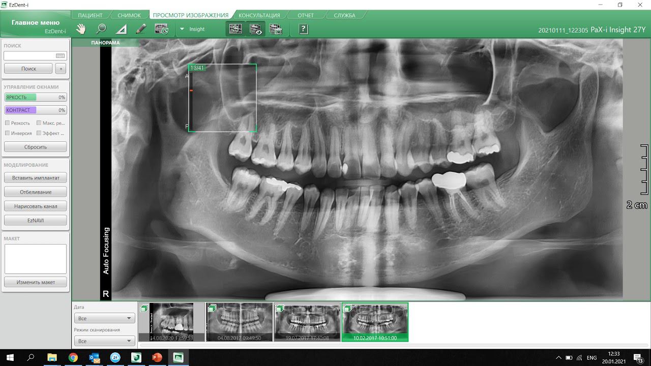 Smart Plus with Insight Pan смотреть онлайн