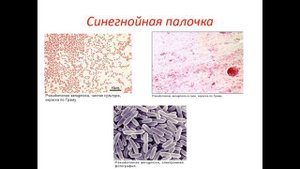 Псевдомонады и синегнойная палочка