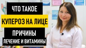 Лечение Купероза на ЛИЦЕ в домашних условиях. Как убрать сосудистые звездочки на лице и теле