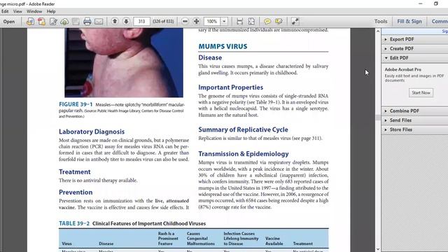 Mumps & Measles || best virology lectures || part 2 смотреть онлайн