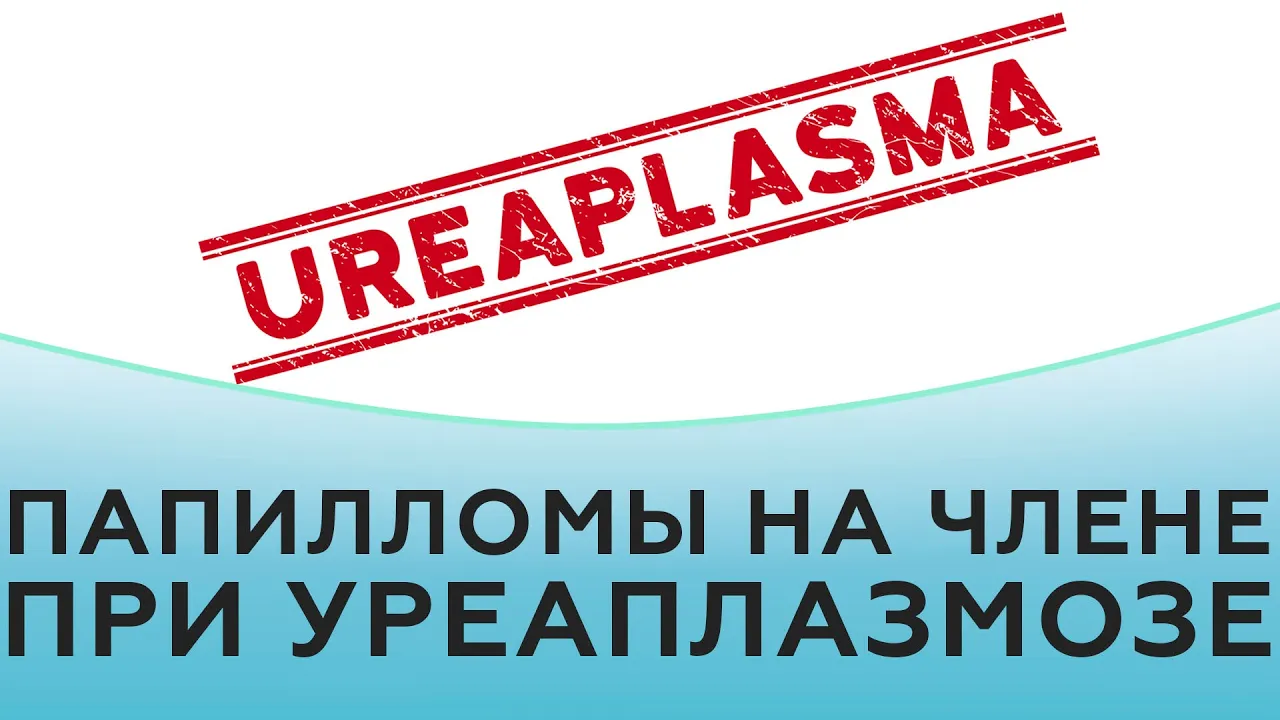Папилломы на члене при уреаплазмозе