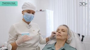 ПОДТЯЖКА ЛИЦА: Процедура Radiesse