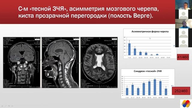 Летягин. "Анатомия ЦНС и формирование внутричерепного давления по данным МРТ"