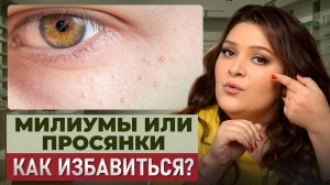 Как БЫСТРО убрать МИЛИУМЫ на лице в домашних условиях?