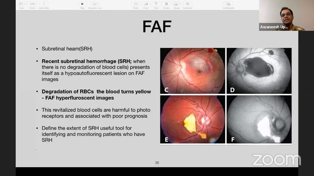 YOSI Resident's Network CME Series : Ocular Trauma Primer смотреть онлайн