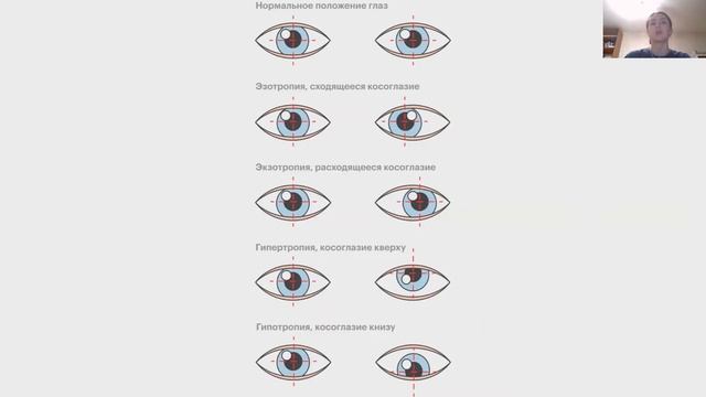 Заболевания глаз. Почему ухудшается зрение?