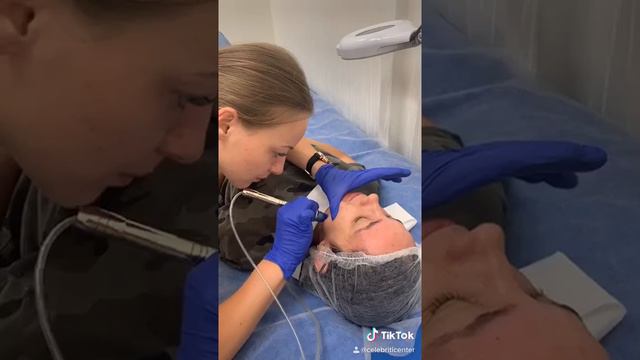 Хайдрафешл! Hydrafacial! Люксовая чистка лица Черкассы!