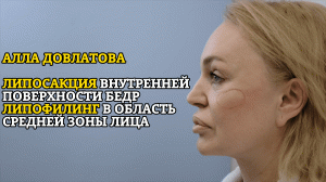 Алла Довлатова: липосакция внутренней поверхности бедер, липофилинг средней зоны лица!