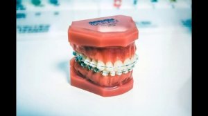 К чему снятся ЗУБЫ во сне. Значение и толкование сна про зубы