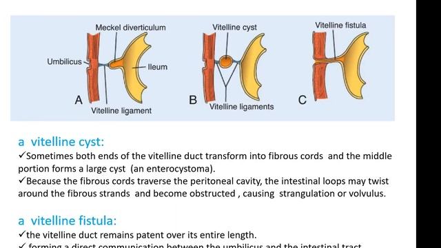 11 Development of GIT смотреть онлайн