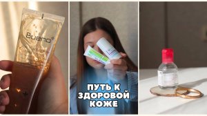 Ретиноиды: как избежать ошибок в лечении акне