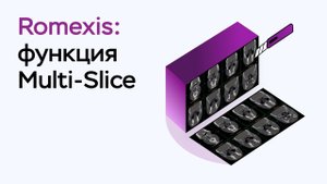 Возможности программы Romexis Viewer: функция Multi-Slice