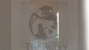 ШОК. ДОСТАЛ ПАРАЗИТА ИЗ ТЕЛА ЧЕЛОВЕКА. 18+ НЕ РЕКОМЕНДУЕТСЯ 21++