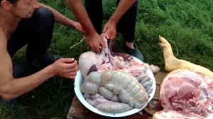 Печень, пораженная эхинококком / Западная Украина