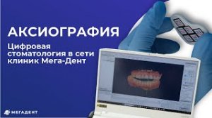 Аксиография - цифровая стоматология в сети стоматологических клиник "Мега-Дент"