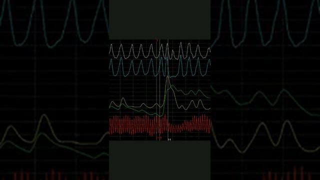 А БЫЛ ЛИ ПОЛИГРАФ? ВОТ ВОПРОС! Влад Бахов. смотреть онлайн