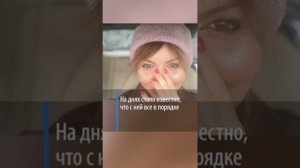 Без носа, худая: в Сети появились новые фото тяжелобольной экс-жены Аршавина