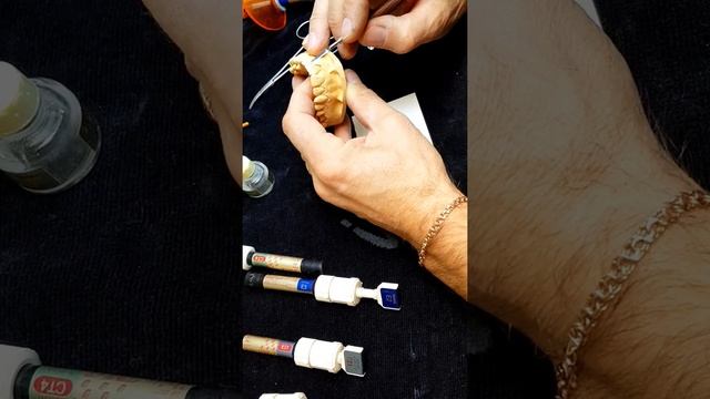 Изготовление безметалловой композитной коронки (фронтальная группа) смотреть онлайн