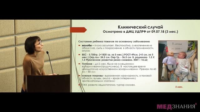 Синдром Корнелии де Ланге (Синдром Брахмана- Ланге. Амстердамская карликовость) смотреть онлайн