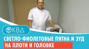 ➡ Светло-фиолетовые пятна и зуд на плоти и головке. Клинический случай №699