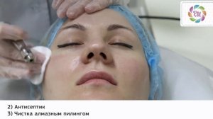 Алмазный пилинг лица | Процедура Роял Медик