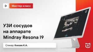 УЗИ сосудов на аппарате Mindray Resona I9