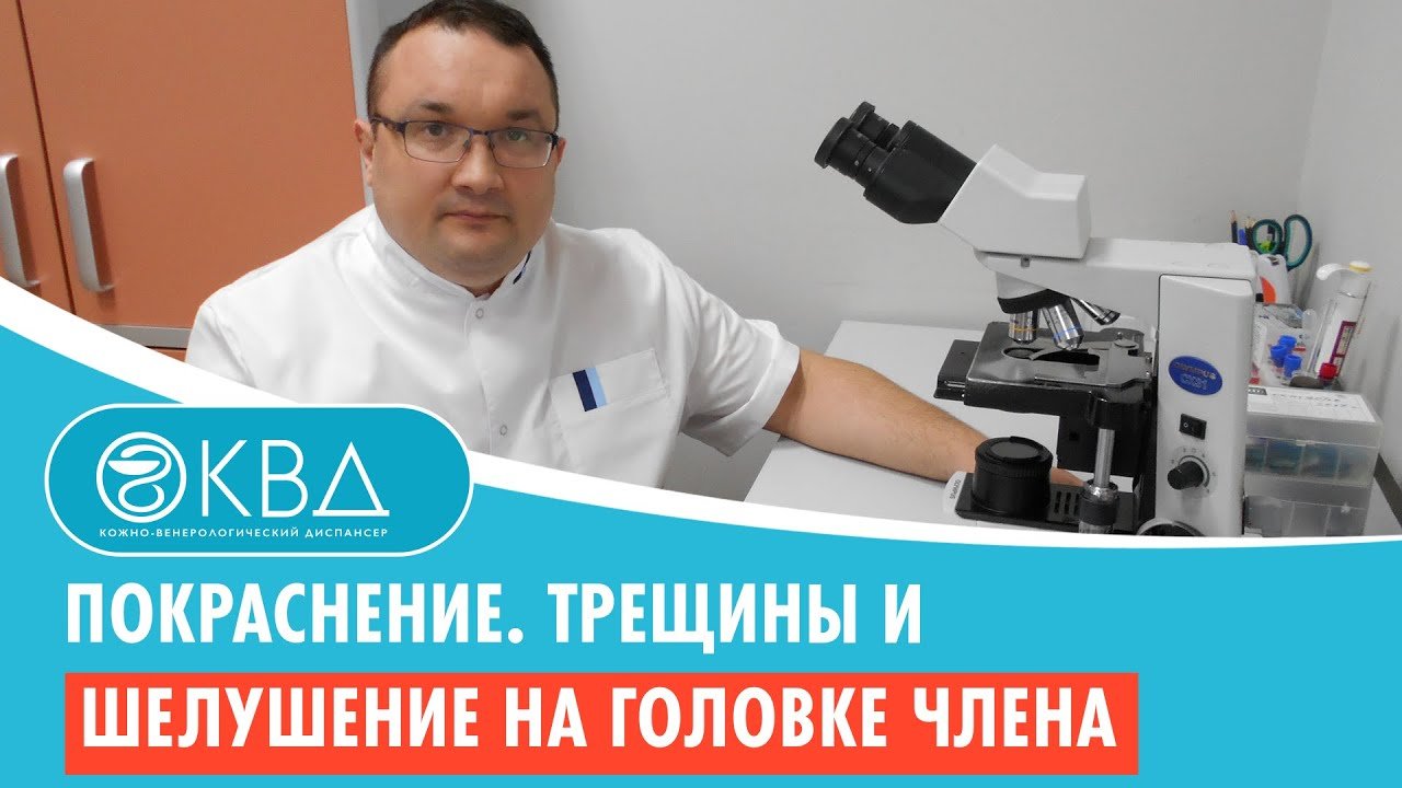 ? Покраснение. Трещины и шелушение на головке члена. Клинический случай №272