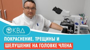 ? Покраснение. Трещины и шелушение на головке члена. Клинический случай №272