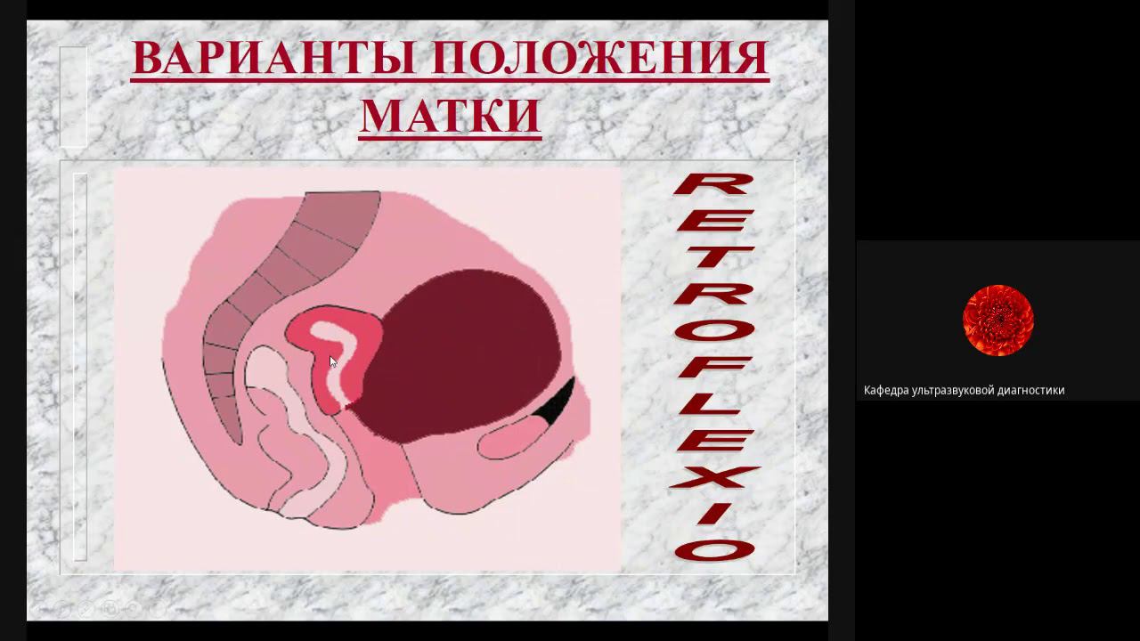 Лекция гинекология 1 Паленый А И смотреть онлайн