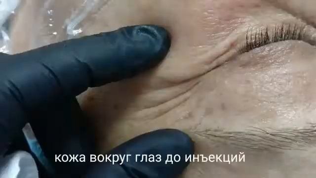 Результат процедуры  