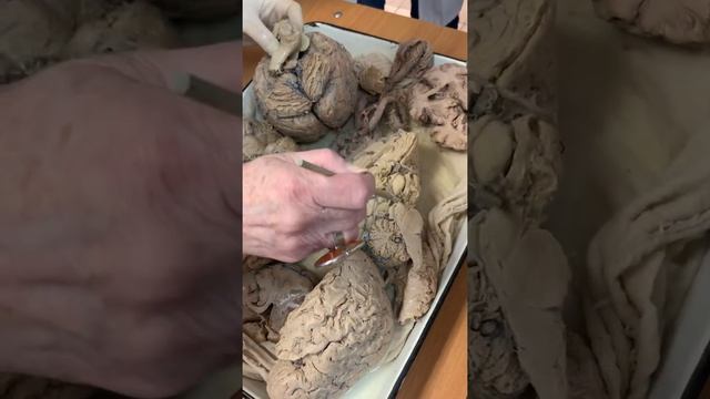 Тыки ЦНС. Экзамен. Соколова Е.А. смотреть онлайн