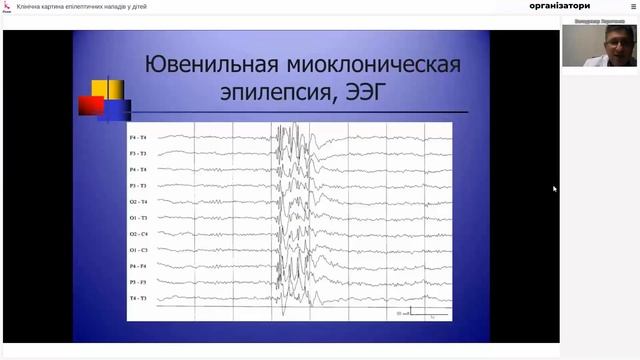 Вебінар «Клінічна картина епілептичних нападів у дітей (з відео презентацією)» смотреть онлайн