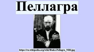 Пеллагра