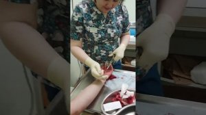 Глубокая рана ?