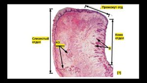 Препарат: Губа (г-э). Сагиттальный срез губы.