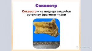 Клинико-анатомические формы некроза | Патологическая анатомия