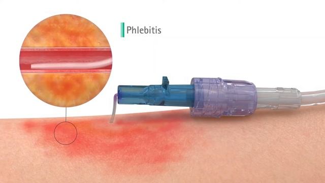 STEADYCare смотреть онлайн