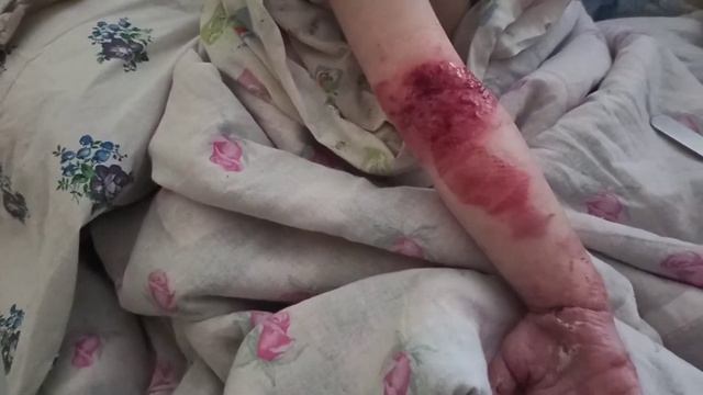 Переехали на дачу??! Маша очень жёстко упала?! почти вся разбилась((((? смотреть онлайн