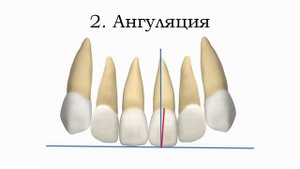6 ключей окклюзии по Эндрюсу