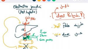 GIT 6 - liver part 2 jaundice