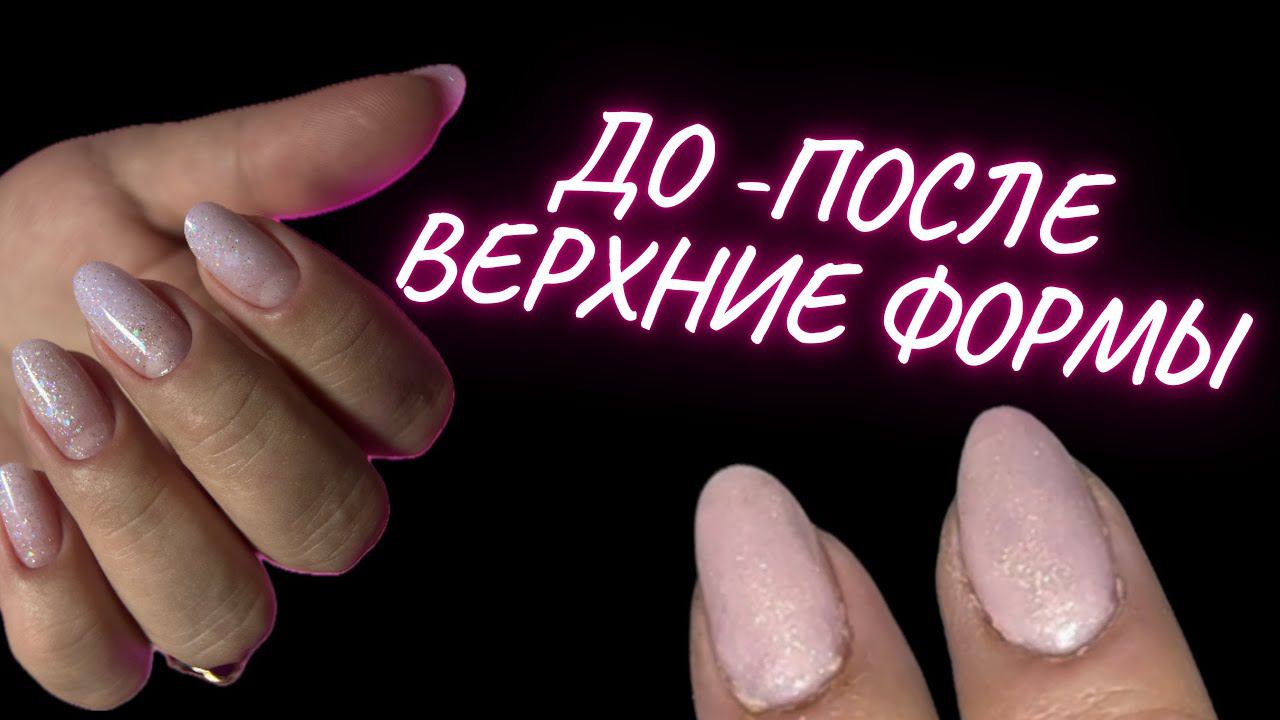 ВЕРХНИЕ ФОРМЫ БЕЗ ЗАТЕКОВ | ПРОПИЛЫ В МАНИКЮРЕ | КОРРЕКЦИЯ НОГТЕЙ