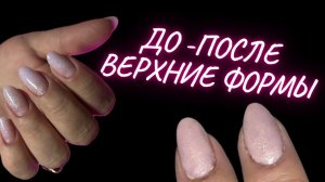 ВЕРХНИЕ ФОРМЫ БЕЗ ЗАТЕКОВ | ПРОПИЛЫ В МАНИКЮРЕ | КОРРЕКЦИЯ НОГТЕЙ